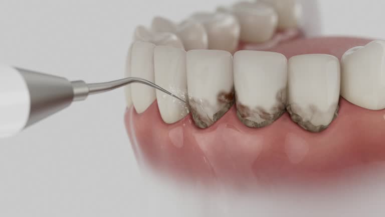 Trusted Teeth Cleaning And Checkup service in Heyburn, ID - Dentist Open Now